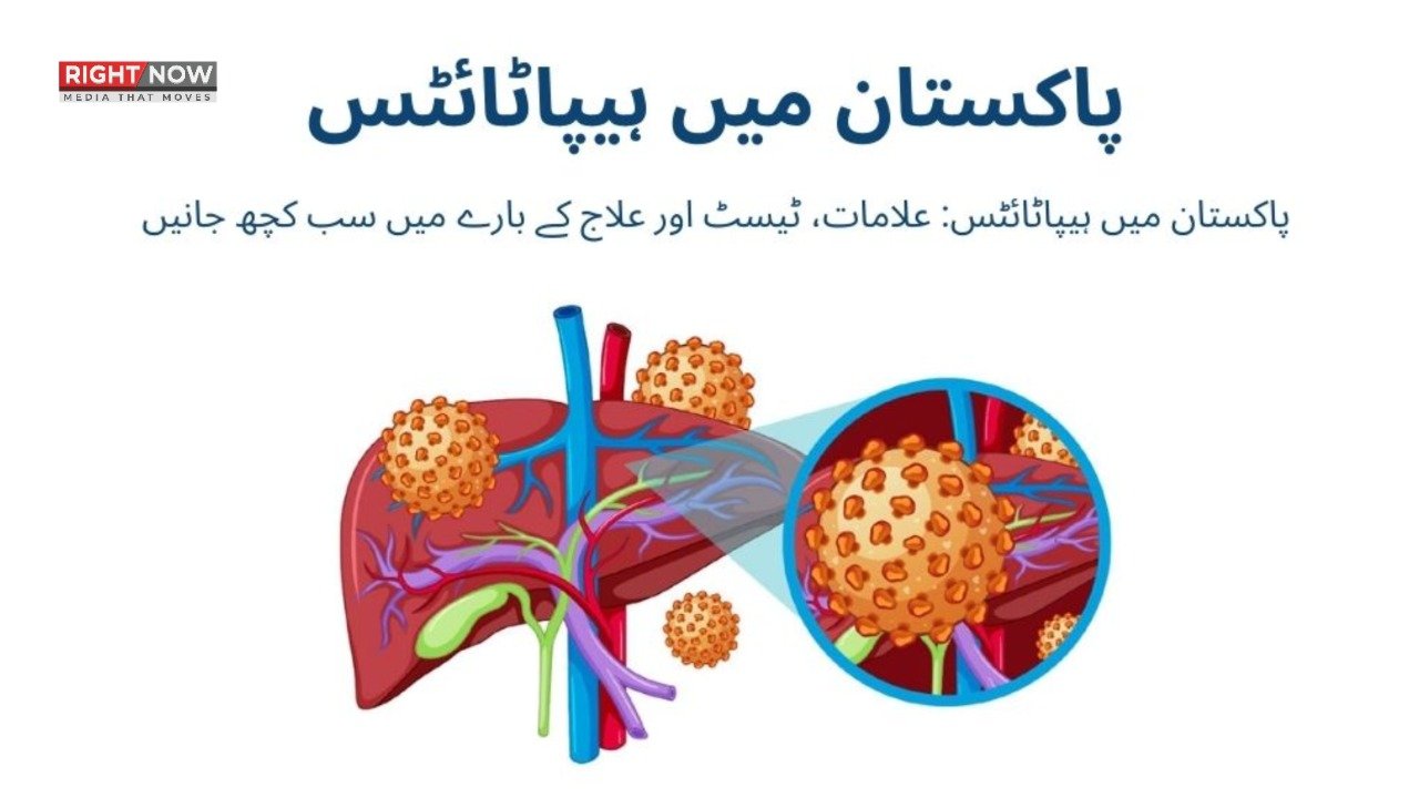 پاکستان میں ہر تیسرا شہری ہیپاٹائٹس کا شکار، صحت کی ہنگامی صورتحال کا اعلان