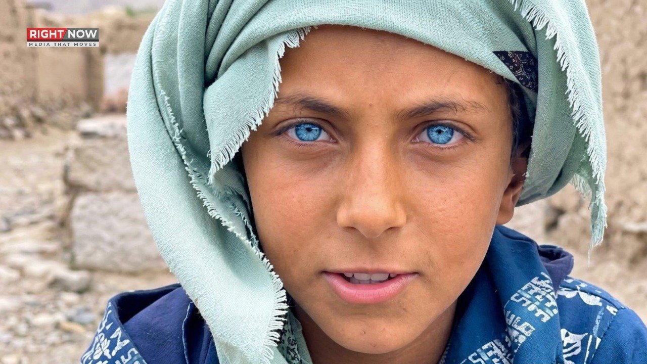یمن: نیلی آنکھوں والا بچہ سوشل میڈیا پر توجہ کا مرکز، 7 لاکھ پسندیدگیاں